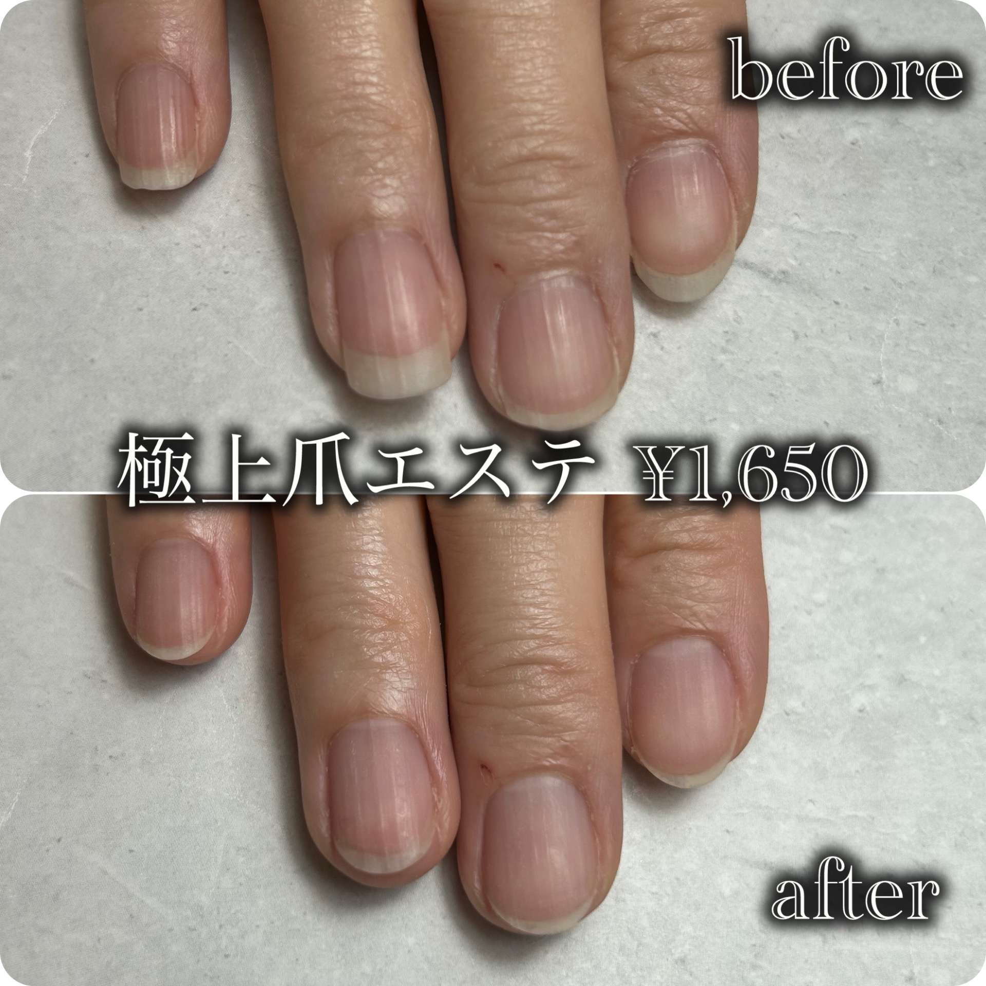 爪周りの角質ケア|千里丘ネイルサロン|atelier classic