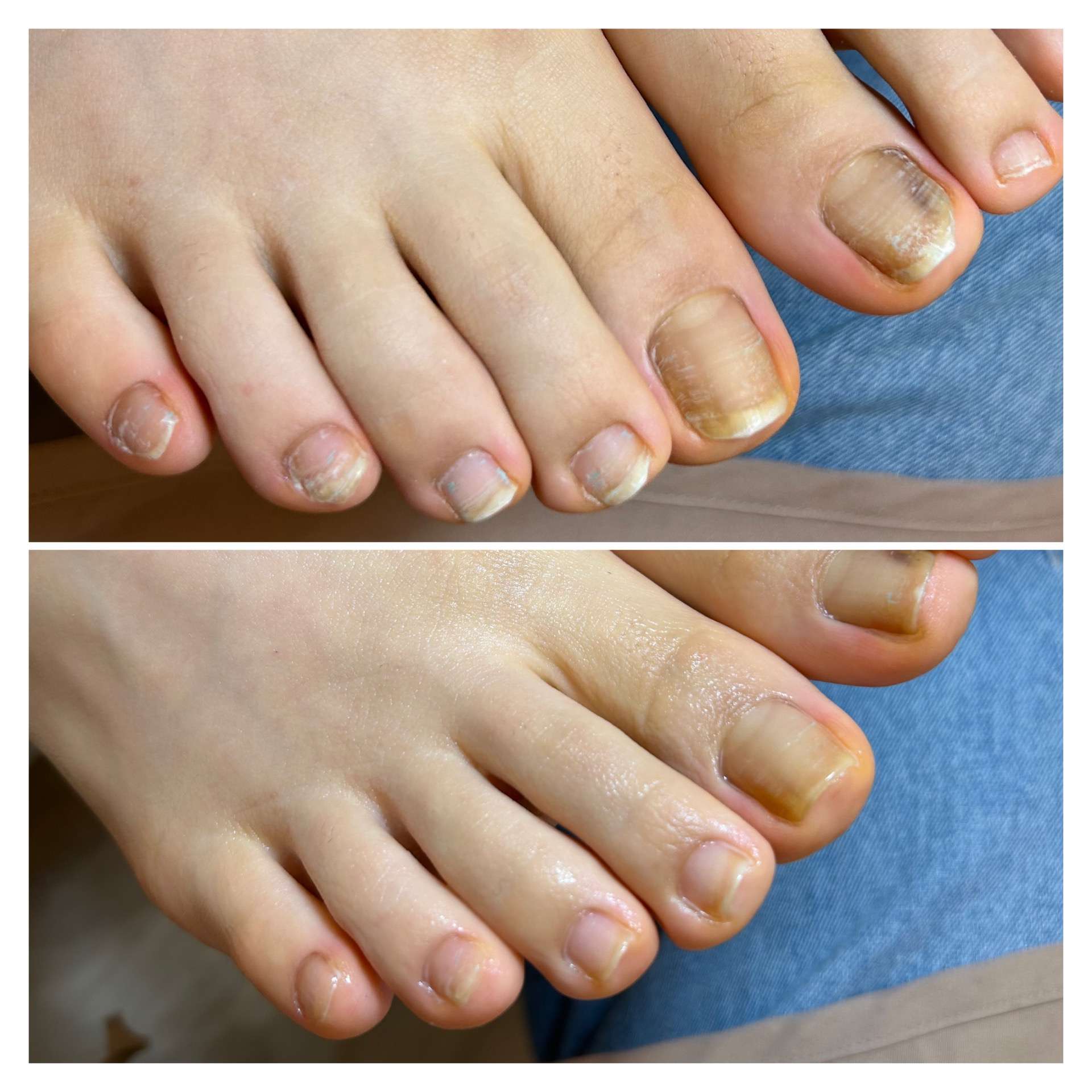 夏の終わりのフットケア|千里丘ネイルサロン|atelier classic