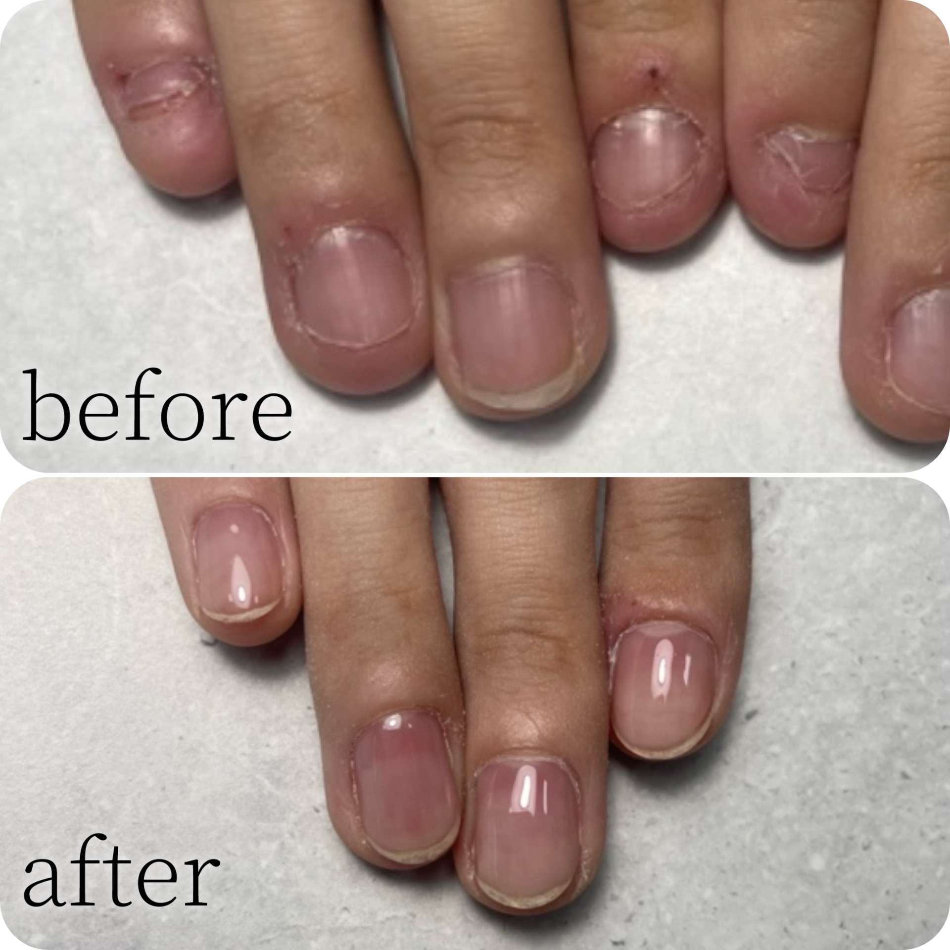 自爪育成|千里丘ネイルサロン|atelier classic